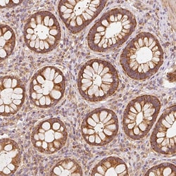 Invitrogen TOMM40 Polyclonal Antibody 100 &mu;L; Unconjugated:Antibodies,