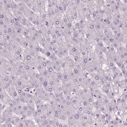 Invitrogen ELOVL3 Polyclonal Antibody 100 &mu;L | Buy Online | Invitrogen&trade; | Fisher Scientific