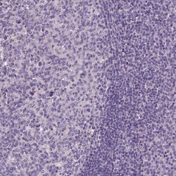 Invitrogen ELOVL3 Polyclonal Antibody 100 &mu;L | Buy Online | Invitrogen&trade; | Fisher Scientific