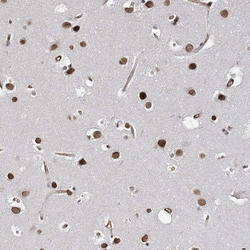 Invitrogen ATP11B Polyclonal Antibody 100 &mu;L; Unconjugated:Antibodies,