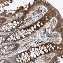 Invitrogen FAM98A Polyclonal Antibody 100 &mu;L; Unconjugated:Antibodies,