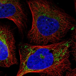 Invitrogen EIF2A Polyclonal Antibody 100 &mu;L; Unconjugated:Antibodies,