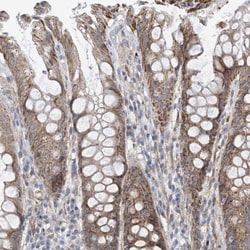 Invitrogen EIF2A Polyclonal Antibody 100 &mu;L; Unconjugated:Antibodies,