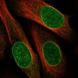Invitrogen DNAJB2 Polyclonal Antibody 100 &mu;L; Unconjugated:Antibodies,