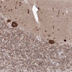 Invitrogen DNAJB2 Polyclonal Antibody 100 &mu;L; Unconjugated:Antibodies,