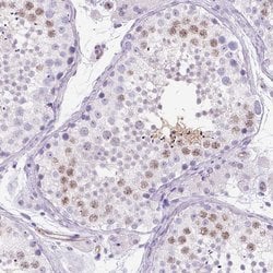 Invitrogen PHF7 Polyclonal Antibody 100 &mu;L; Unconjugated:Antibodies,