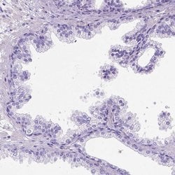 Invitrogen PHF7 Polyclonal Antibody 100 &mu;L; Unconjugated:Antibodies,