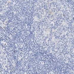 Invitrogen SPINK7 Polyclonal Antibody 100 &mu;L | Buy Online | Invitrogen&trade; | Fisher Scientific