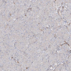 Invitrogen ARHGAP30 Polyclonal Antibody 100 &mu;L; Unconjugated:Antibodies,