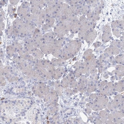 Invitrogen VSIG1 Polyclonal Antibody 100 &mu;L; Unconjugated:Antibodies,