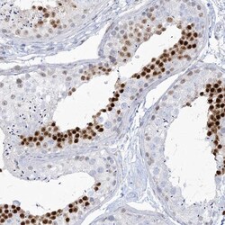 Invitrogen HOMEZ Polyclonal Antibody 100 &mu;L; Unconjugated:Antibodies,