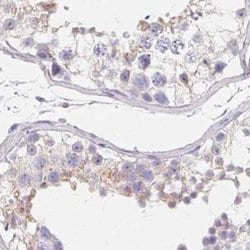 Invitrogen ZBBX Polyclonal Antibody 100 &mu;L; Unconjugated:Antibodies,