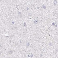 Invitrogen ZBBX Polyclonal Antibody 100 &mu;L; Unconjugated:Antibodies,