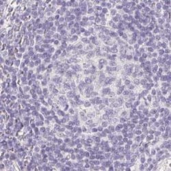Invitrogen ZBBX Polyclonal Antibody 100 &mu;L; Unconjugated:Antibodies,