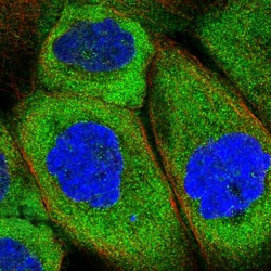 Invitrogen ABCF3 Polyclonal Antibody 100 &mu;L; Unconjugated:Antibodies,