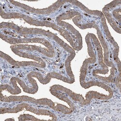 Invitrogen ABCF3 Polyclonal Antibody 100 &mu;L; Unconjugated:Antibodies,