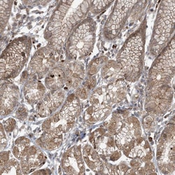 Invitrogen ABCF3 Polyclonal Antibody 100 &mu;L; Unconjugated:Antibodies,