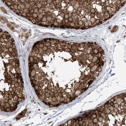 Invitrogen ABCF3 Polyclonal Antibody 100 &mu;L; Unconjugated:Antibodies,