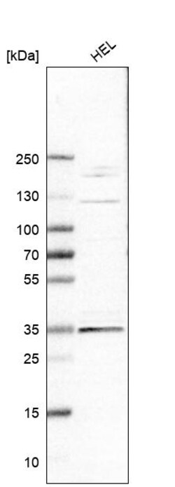 Invitrogen ELOVL7 Polyclonal Antibody 100 &mu;L; Unconjugated:Antibodies,