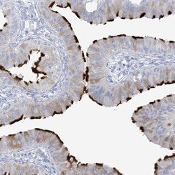 Invitrogen ADGB Polyclonal Antibody 100 &mu;L; Unconjugated:Antibodies,