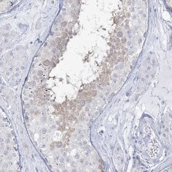Invitrogen ADGB Polyclonal Antibody 100 &mu;L; Unconjugated:Antibodies,
