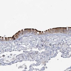 Invitrogen ADGB Polyclonal Antibody 100 &mu;L; Unconjugated:Antibodies,