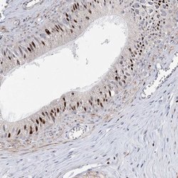 CAMTA1 Rabbit anti-Human, Polyclonal, Invitrogen 100 &mu;L; Unconjugated:Antibodies,