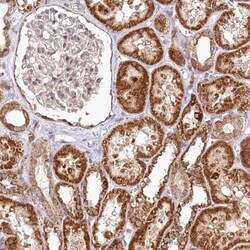 Invitrogen RTN4IP1 Polyclonal Antibody 100 &mu;L; Unconjugated:Antibodies,