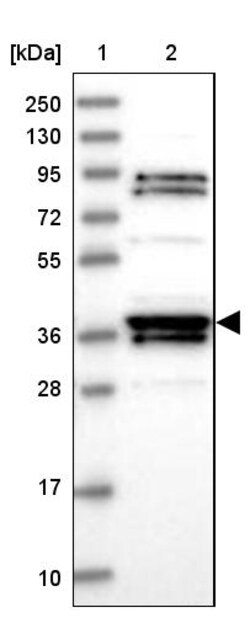 Invitrogen RTN4IP1 Polyclonal Antibody 100 &mu;L; Unconjugated:Antibodies,