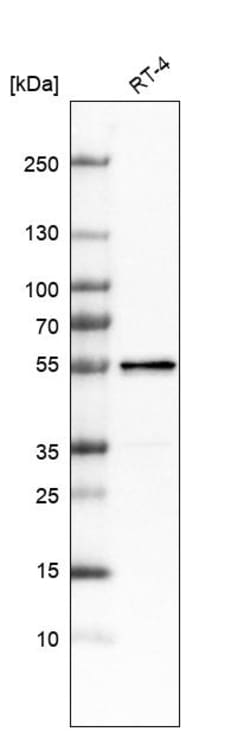 Invitrogen LACTB Polyclonal Antibody 100 &mu;L | Buy Online | Invitrogen&trade; | Fisher Scientific