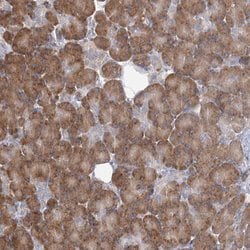 Invitrogen LACTB Polyclonal Antibody 100 &mu;L | Buy Online | Invitrogen&trade; | Fisher Scientific