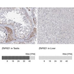 Invitrogen ZNF821 Polyclonal Antibody 100 &mu;L | Buy Online | Invitrogen&trade; | Fisher Scientific