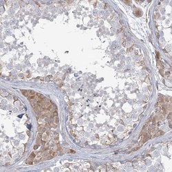 Invitrogen ZNF821 Polyclonal Antibody 100 &mu;L | Buy Online | Invitrogen&trade; | Fisher Scientific