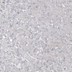 Invitrogen ZNF821 Polyclonal Antibody 100 &mu;L | Buy Online | Invitrogen&trade; | Fisher Scientific