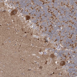 Invitrogen OBSL1 Polyclonal Antibody 100 &mu;L; Unconjugated:Antibodies,