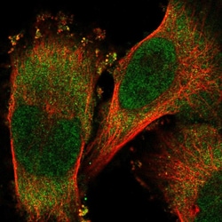 RNF25 Polyclonal Antibody:Antibodies, Polyclonal
