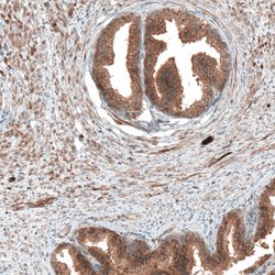 Invitrogen DMXL1 Polyclonal Antibody 100 &mu;L; Unconjugated:Antibodies,