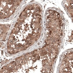 Invitrogen DMXL1 Polyclonal Antibody 100 &mu;L; Unconjugated:Antibodies,