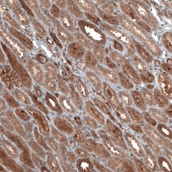 Invitrogen DMXL1 Polyclonal Antibody 100 &mu;L; Unconjugated:Antibodies,