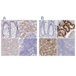 Invitrogen DMGDH Polyclonal Antibody 100 &mu;L; Unconjugated:Antibodies,