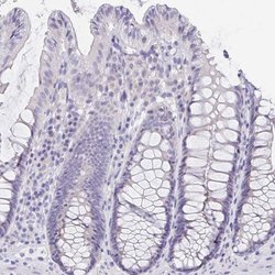 Invitrogen DMGDH Polyclonal Antibody 100 &mu;L; Unconjugated:Antibodies,