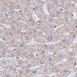 Invitrogen DMGDH Polyclonal Antibody 100 &mu;L; Unconjugated:Antibodies,