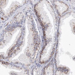 Invitrogen SAB Polyclonal Antibody 100 &mu;L | Buy Online | Invitrogen&trade; | Fisher Scientific