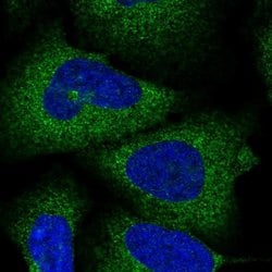 Invitrogen SPAT5 Polyclonal Antibody 100 &mu;L; Unconjugated:Antibodies,
