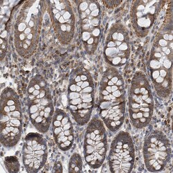 Invitrogen SPAT5 Polyclonal Antibody 100 &mu;L; Unconjugated:Antibodies,