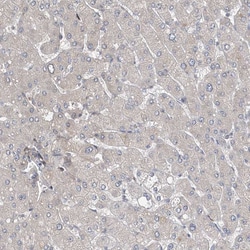 Invitrogen SPAT5 Polyclonal Antibody 100 &mu;L; Unconjugated:Antibodies,