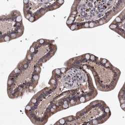 Invitrogen PHYKPL Polyclonal Antibody 100 &mu;L; Unconjugated:Antibodies,