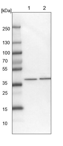 Invitrogen PHYKPL Polyclonal Antibody 100 &mu;L | Buy Online | Invitrogen&trade; | Fisher Scientific