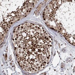 Invitrogen DCUN1D4 Polyclonal Antibody 100 &mu;L; Unconjugated:Antibodies,