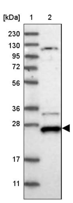 Invitrogen DCUN1D4 Polyclonal Antibody 100 &mu;L | Buy Online | Invitrogen&trade; | Fisher Scientific